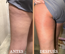 Cargar imagen en el visor de la galería, Masajeador Anticelulítico/Sculp5 Pro™